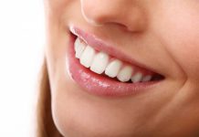 ציפוי שיניים – לאחר 5 הדקות הקרובות תדעו כל מה שאתם צריכים לדעת