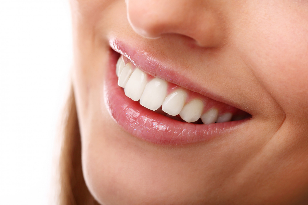 ציפוי שיניים – לאחר 5 הדקות הקרובות תדעו כל מה שאתם צריכים לדעת