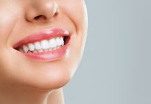 סוגי ציפויים לשיניים ומהו הציפוי הפופולרי ביותר?
