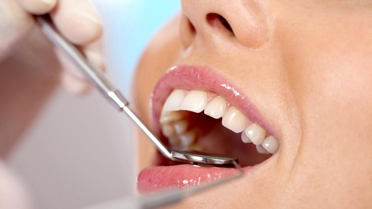 איך משמרים תוצאות יישור שיניים