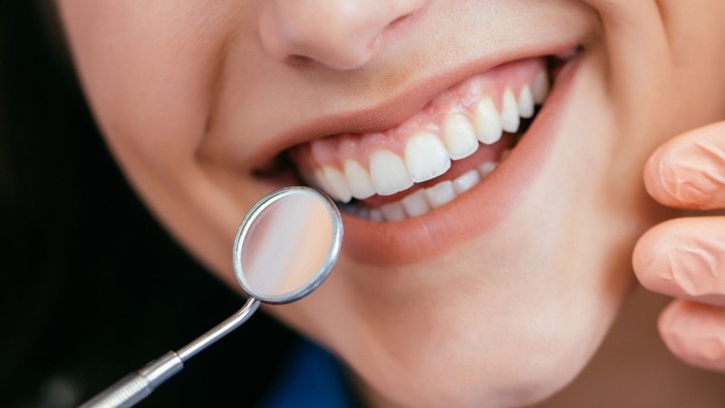 עקירה של שן בינה